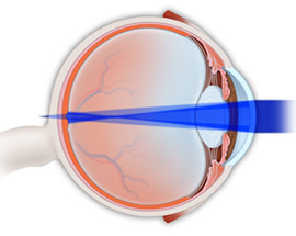 Comprehensive Eye Care | Dry Eye Treatment | Glaucoma Diagnosis | Contact Lenses Algonquin IL | Mundelein IL